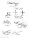 Fig. 64 - Endoluminal filter having enhanced echogenic properties