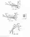 Fig. 67 - Endoluminal filter having enhanced echogenic properties