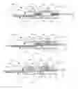 Fig. 04 - Dual needle core biopsy instrument