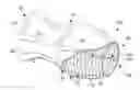 Fig. 01 - Intraluminal occlusion devices and methods of blocking the entry of fluid into bodily passages