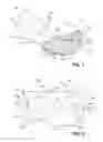 Fig. 02 - Intraluminal occlusion devices and methods of blocking the entry of fluid into bodily passages