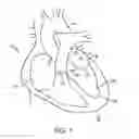 Fig. 02 - METHOD FOR PROVIDING SURGICAL ACCESS
