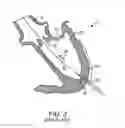Fig. 03 - METHOD FOR PROVIDING SURGICAL ACCESS
