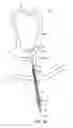 Fig. 04 - METHOD FOR PROVIDING SURGICAL ACCESS