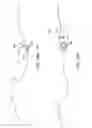 Fig. 111 - METHOD FOR PROVIDING SURGICAL ACCESS