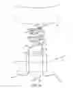 Fig. 28 - METHOD FOR PROVIDING SURGICAL ACCESS