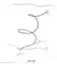 Fig. 38 - METHOD FOR PROVIDING SURGICAL ACCESS