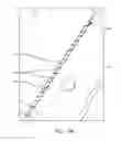 Fig. 41 - METHOD FOR PROVIDING SURGICAL ACCESS