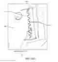 Fig. 44 - METHOD FOR PROVIDING SURGICAL ACCESS