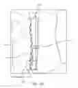 Fig. 45 - METHOD FOR PROVIDING SURGICAL ACCESS