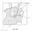 Fig. 53 - METHOD FOR PROVIDING SURGICAL ACCESS