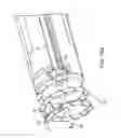 Fig. 61 - METHOD FOR PROVIDING SURGICAL ACCESS