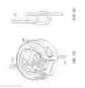 Fig. 66 - METHOD FOR PROVIDING SURGICAL ACCESS
