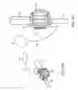 Fig. 88 - METHOD FOR PROVIDING SURGICAL ACCESS