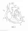 Fig. 02 - SYSTEM FOR PROVIDING SURGICAL ACCESS