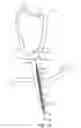 Fig. 04 - SYSTEM FOR PROVIDING SURGICAL ACCESS
