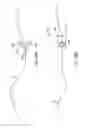 Fig. 111 - SYSTEM FOR PROVIDING SURGICAL ACCESS