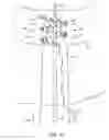 Fig. 20 - SYSTEM FOR PROVIDING SURGICAL ACCESS