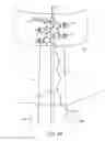 Fig. 22 - SYSTEM FOR PROVIDING SURGICAL ACCESS