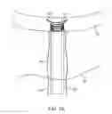 Fig. 34 - SYSTEM FOR PROVIDING SURGICAL ACCESS