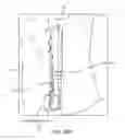 Fig. 45 - SYSTEM FOR PROVIDING SURGICAL ACCESS