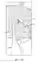 Fig. 50 - SYSTEM FOR PROVIDING SURGICAL ACCESS
