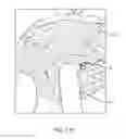 Fig. 51 - SYSTEM FOR PROVIDING SURGICAL ACCESS