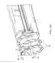 Fig. 62 - SYSTEM FOR PROVIDING SURGICAL ACCESS
