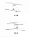 Fig. 02 - SURGICAL STAPLER