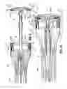 Fig. 10 - Surgical instruments employing sensors