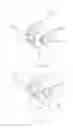 Fig. 16 - URETHRAL ANASTOMOSIS DEVICE AND METHOD