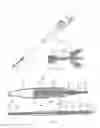 Fig. 23 - URETHRAL ANASTOMOSIS DEVICE AND METHOD