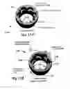 Fig. 52 - URETHRAL ANASTOMOSIS DEVICE AND METHOD