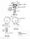 Fig. 65 - URETHRAL ANASTOMOSIS DEVICE AND METHOD