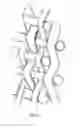 Fig. 04 - NEURAL IMPLANT