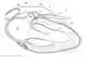 Fig. 01 - TISSUE CAPTURE AND OCCLUSION SYSTEMS AND METHODS