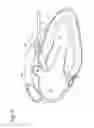 Fig. 03 - TISSUE CAPTURE AND OCCLUSION SYSTEMS AND METHODS