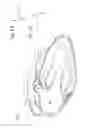 Fig. 05 - TISSUE CAPTURE AND OCCLUSION SYSTEMS AND METHODS