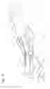 Fig. 11 - TISSUE CAPTURE AND OCCLUSION SYSTEMS AND METHODS