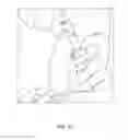 Fig. 21 - Device and methods for fracture reduction