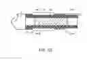 Fig. 30 - Device and methods for fracture reduction