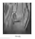Fig. 11 - System and method for image segmentation in generating computer models of a joint to undergo arthroplasty