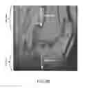 Fig. 13 - System and method for image segmentation in generating computer models of a joint to undergo arthroplasty