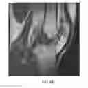 Fig. 15 - System and method for image segmentation in generating computer models of a joint to undergo arthroplasty