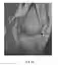 Fig. 23 - System and method for image segmentation in generating computer models of a joint to undergo arthroplasty