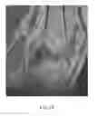 Fig. 24 - System and method for image segmentation in generating computer models of a joint to undergo arthroplasty