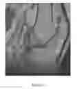 Fig. 25 - System and method for image segmentation in generating computer models of a joint to undergo arthroplasty