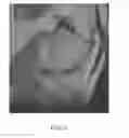 Fig. 27 - System and method for image segmentation in generating computer models of a joint to undergo arthroplasty