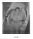 Fig. 30 - System and method for image segmentation in generating computer models of a joint to undergo arthroplasty