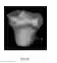 Fig. 32 - System and method for image segmentation in generating computer models of a joint to undergo arthroplasty